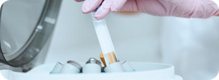 A doctor removes a tube from a centrifuge to use in a platelet-rich plasma therapy treatment